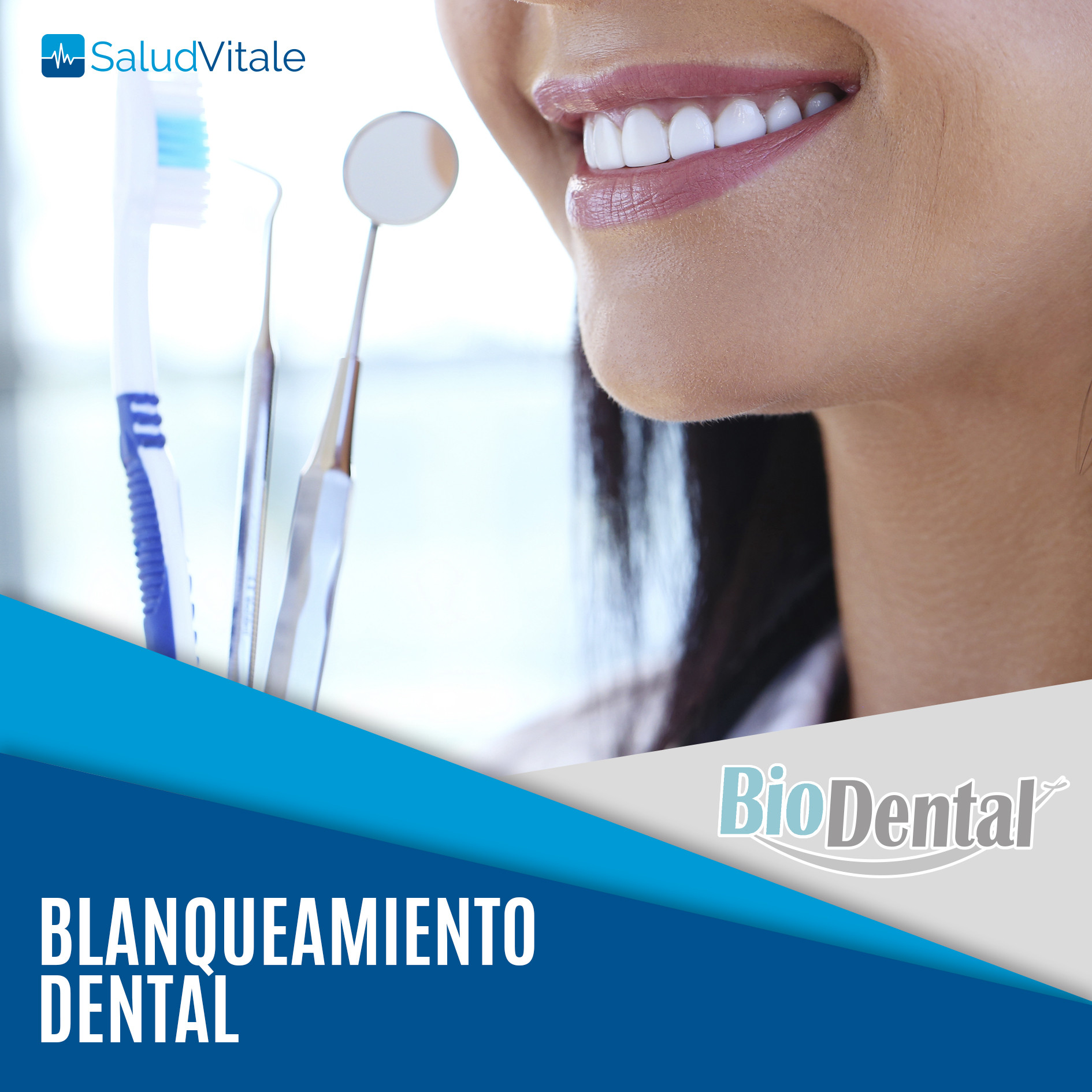 Blanqueamiento Dental