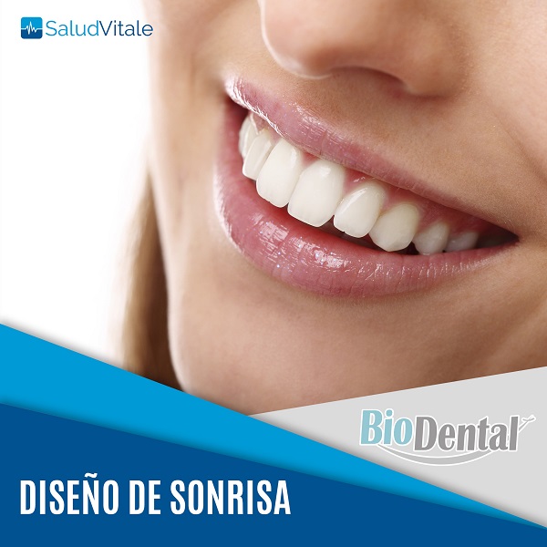 Diseño de Sonrisa