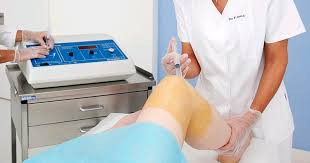 Ozono Intraarticular