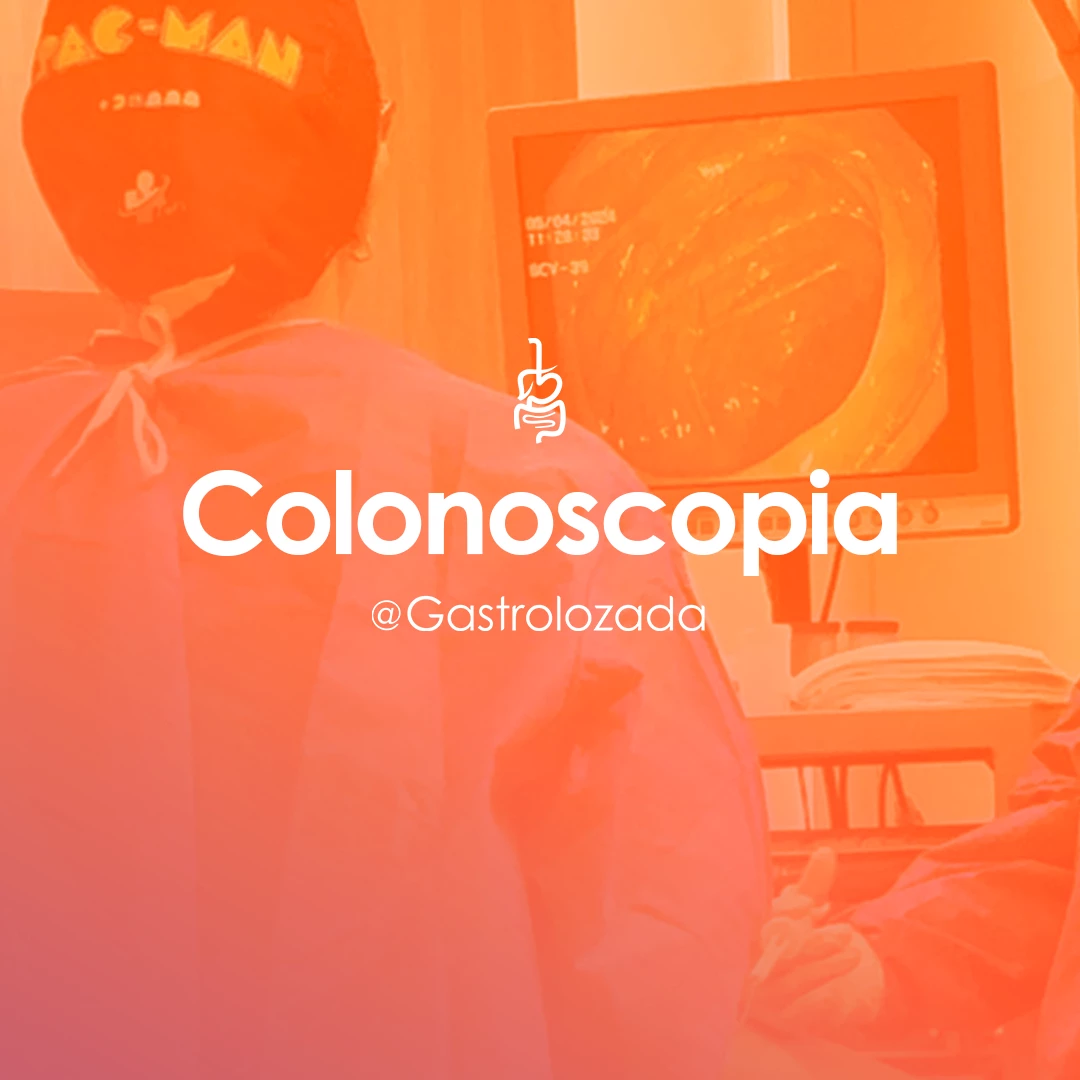 Colonoscopia